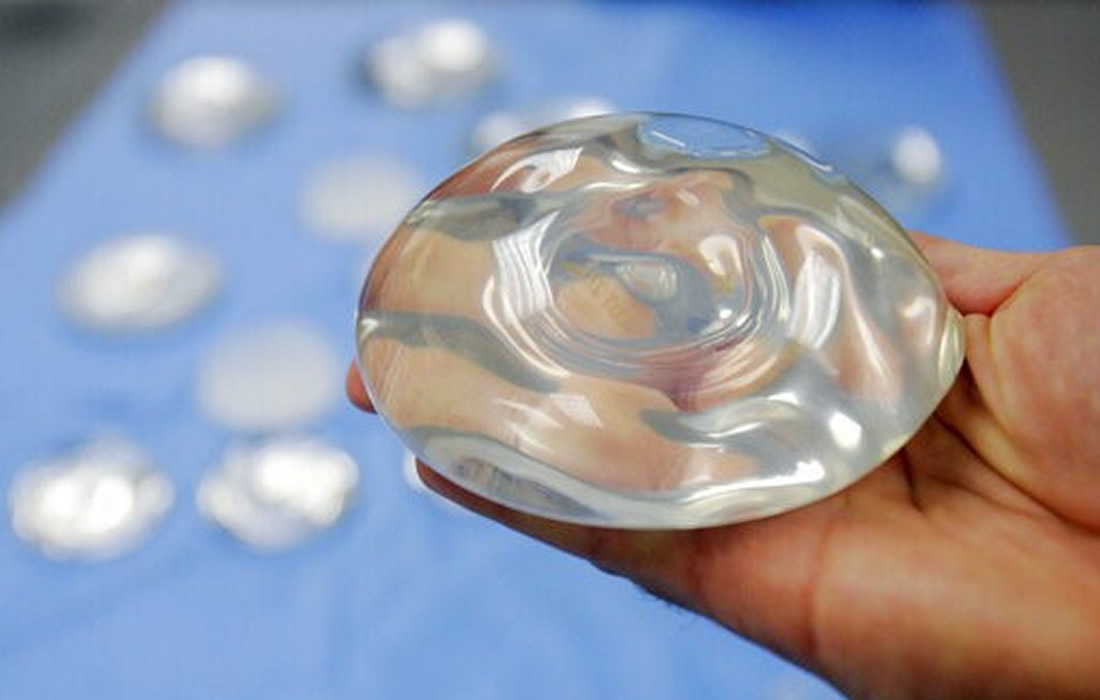Silicone breast implants linked to increased risk of some rare harms