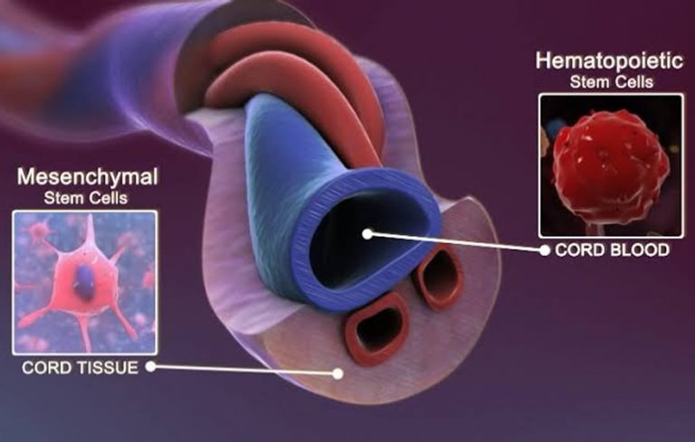 umbilical-cord-stem-cells-shop-dr-ramon-ramon-de-la-puerta-md