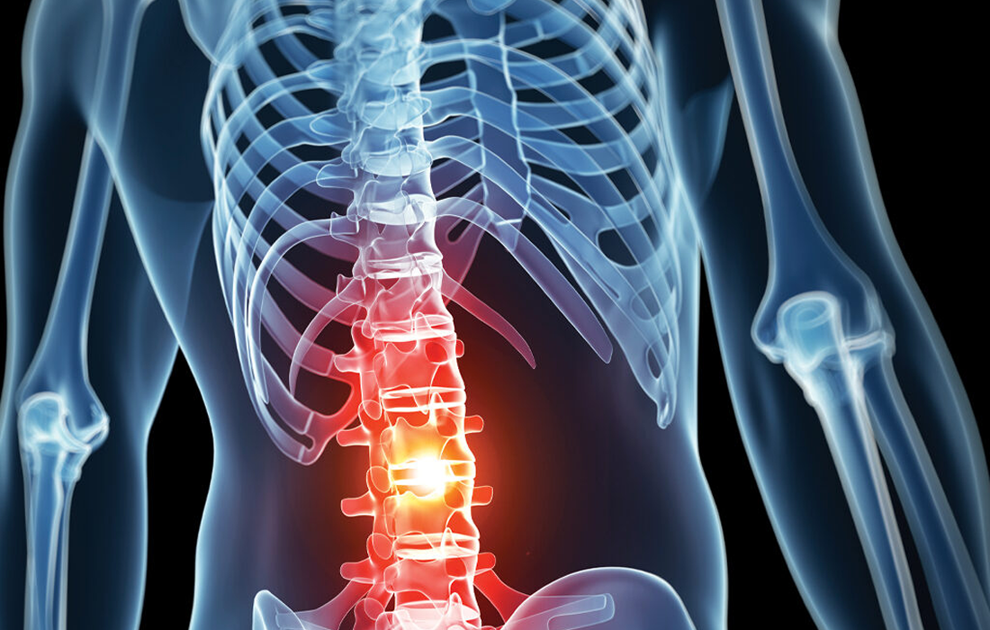 Stem Cell Therapy for Chronic Back Pain - Stemcell Therapy in California