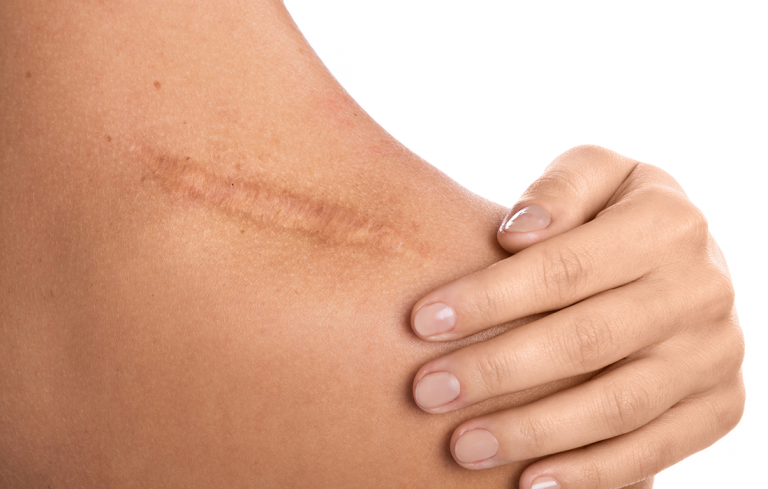 How Skin Stem Cells Regenerate Skin Shop Dr Ramon Ramon De La how-skin-stem-cells-regenerate-skin-shop-dr-ramon-ramon-de-la
