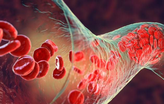 A Drug for Inflammatory Conditions can Rejuvenate Blood Cells - Dr. Ramon - Ramon De La Puerta, MD